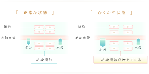 正常な状態 むくんだ状態